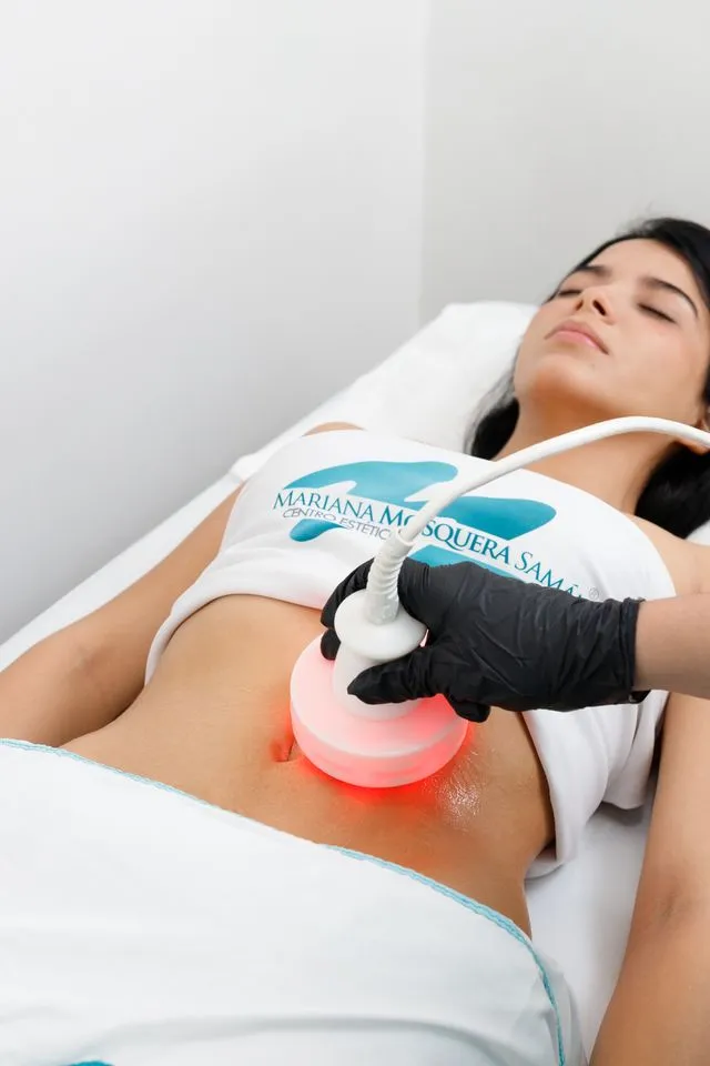 Tratamiento Lipolaser - Mariana Mosquera